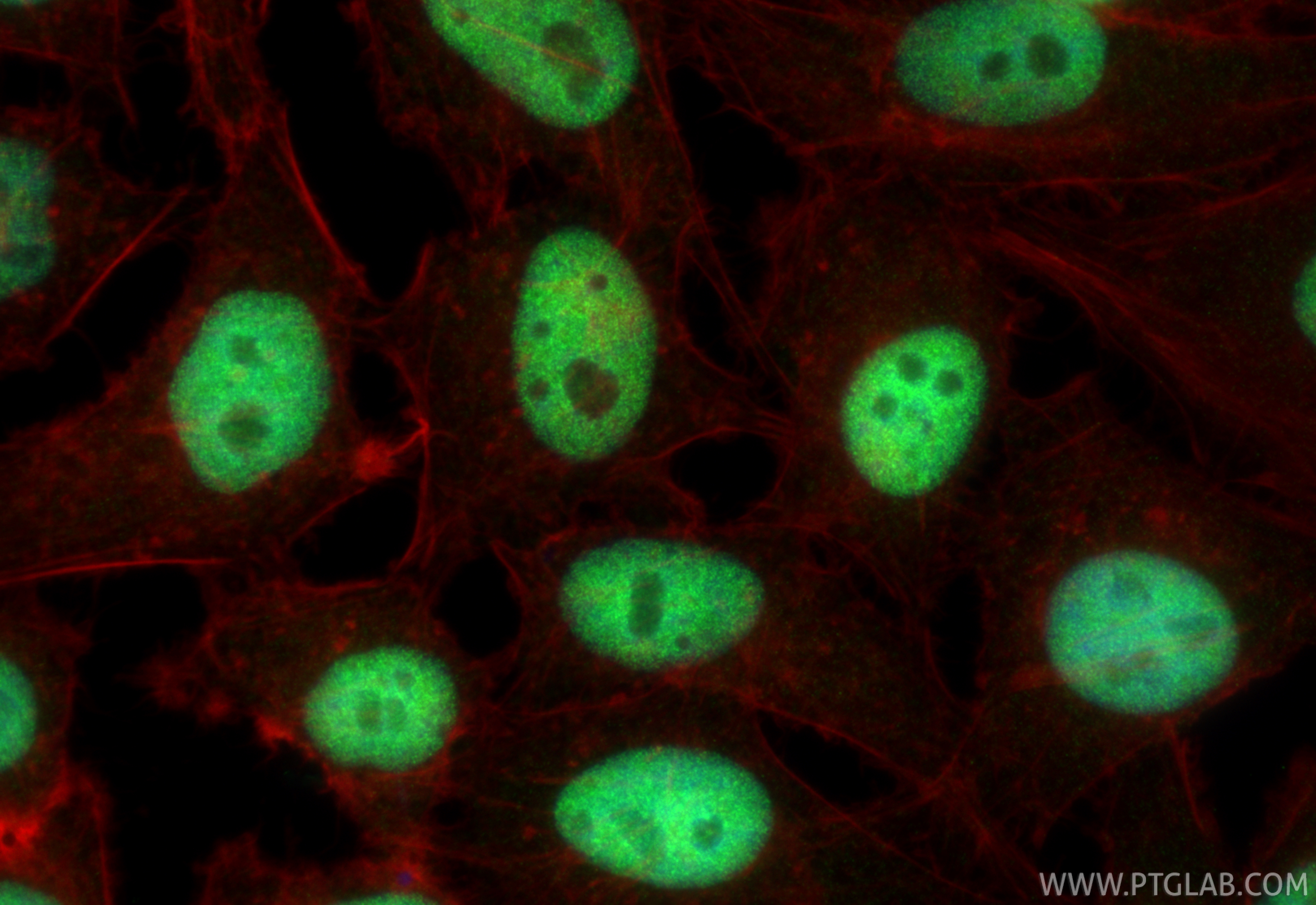 IF Staining of HeLa using RMX00101 IF Staining of HeLa using RMX00101