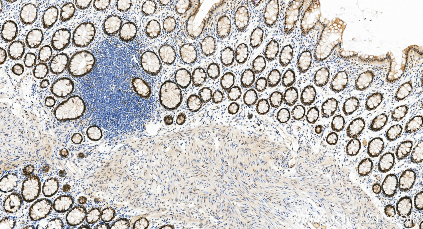 IHC staining of human colon using RMX00101 IHC staining of human colon using RMX00101