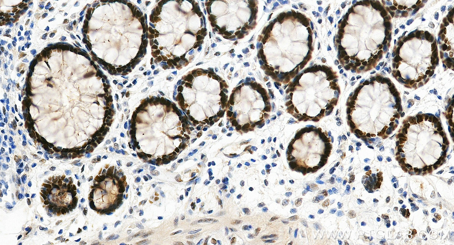 IHC staining of human colon using RMX00101 IHC staining of human colon using RMX00101
