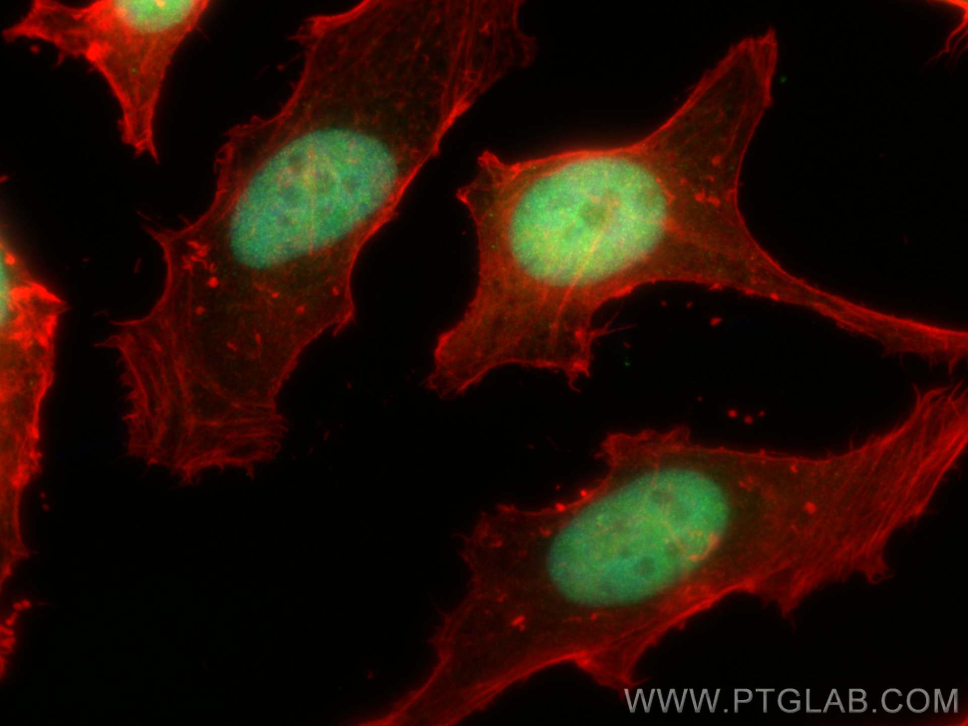 IF Staining of HeLa using 29765-1-AP