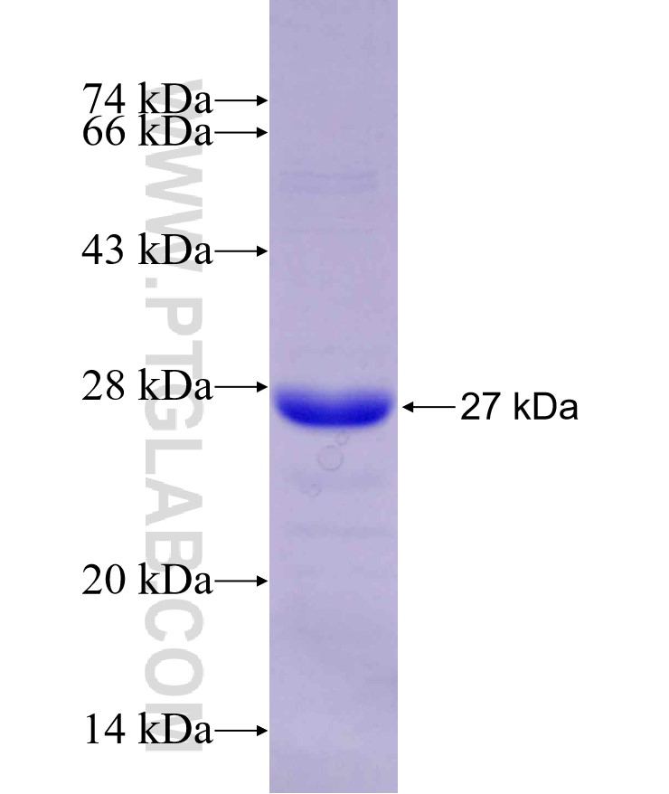 POLD2 fusion protein Ag29866 SDS-PAGE POLD2 fusion protein Ag29866 SDS-PAGE