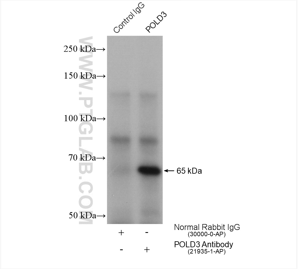 IP experiment of MCF-7 using 21935-1-AP