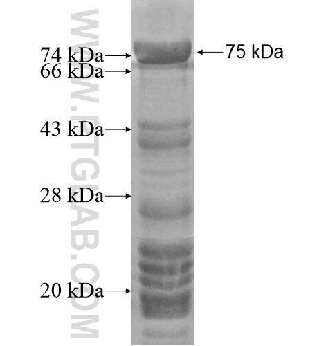POLD3 fusion protein Ag15893 SDS-PAGE POLD3 fusion protein Ag15893 SDS-PAGE