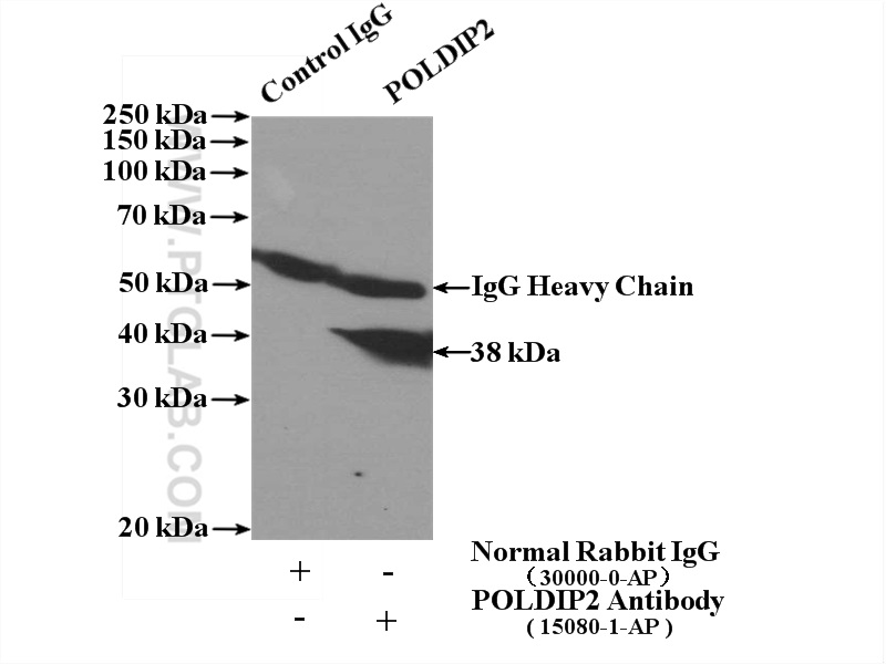 IP experiment of HeLa using 15080-1-AP