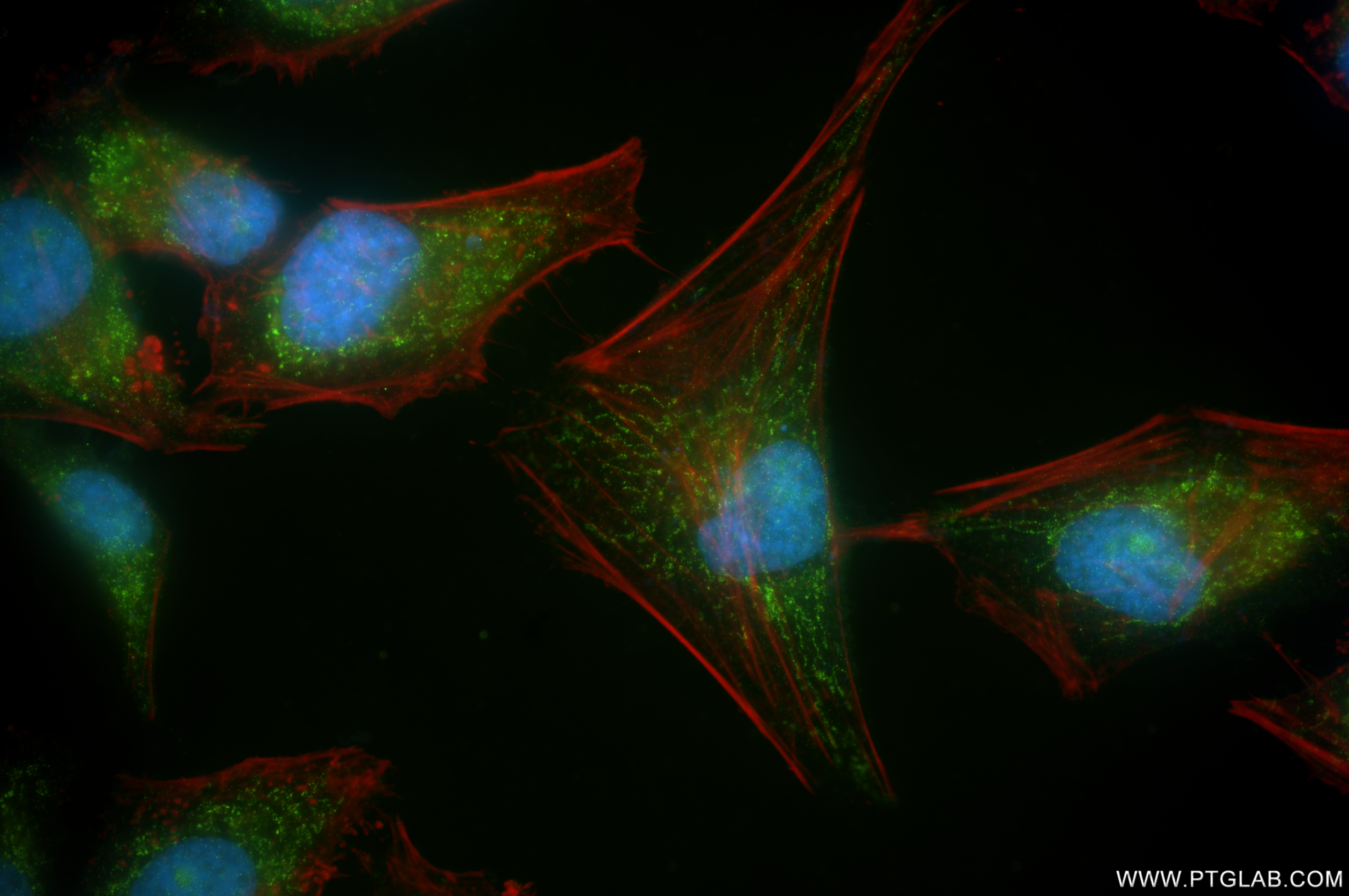 IF Staining of HeLa using 86232-3-RR