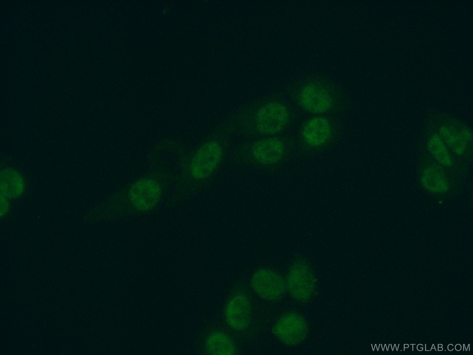 IF Staining of HeLa using 17466-1-AP