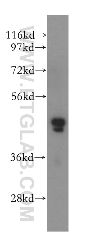 WB analysis of HeLa using 17466-1-AP