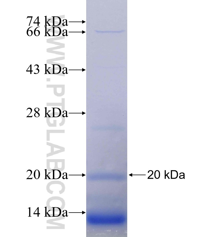 POLE fusion protein Ag30055 SDS-PAGE POLE fusion protein Ag30055 SDS-PAGE
