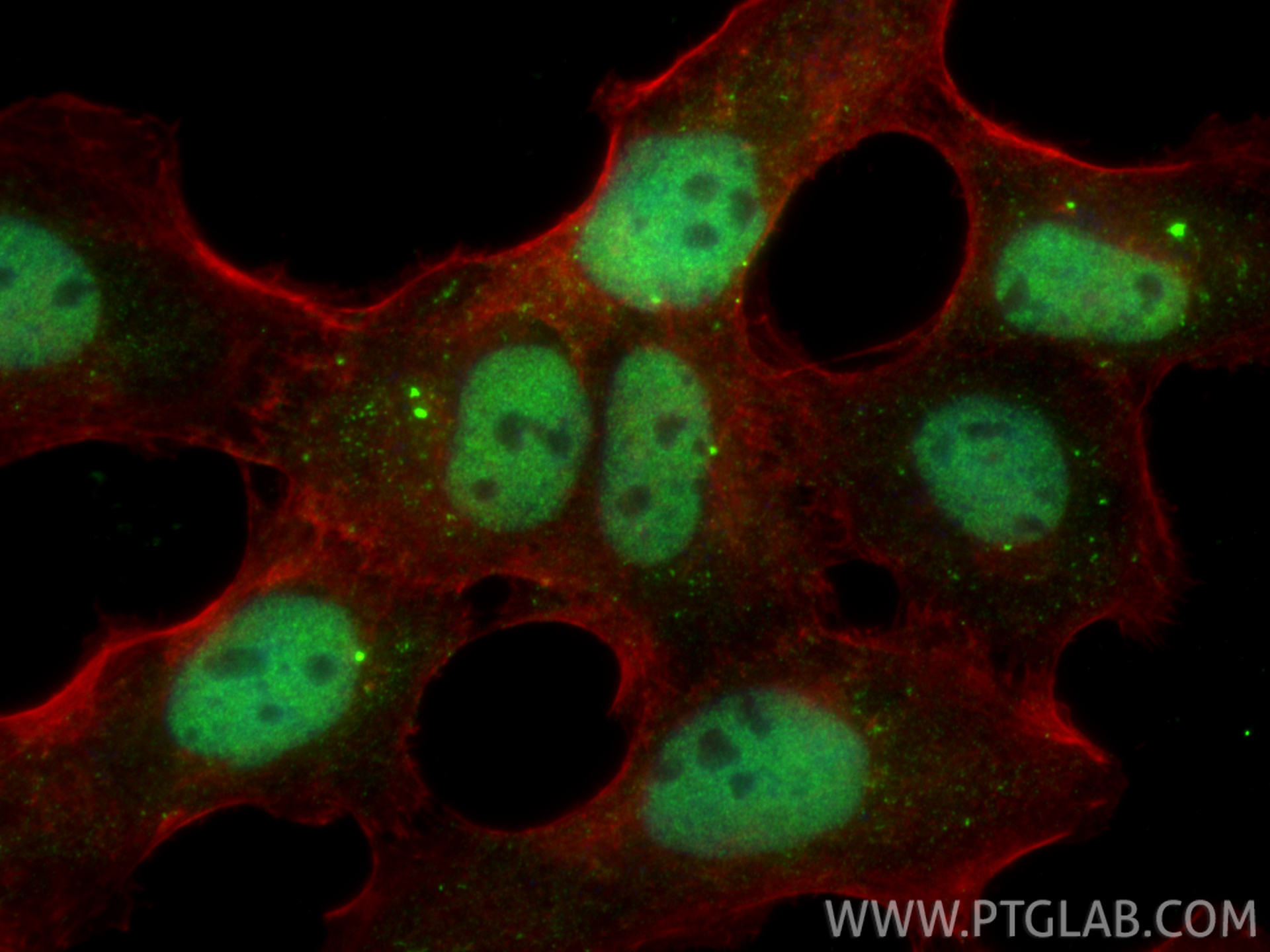 IF Staining of A431 using 33482-1-AP