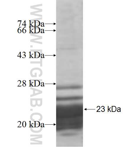 POLE3 fusion protein Ag7871 SDS-PAGE POLE3 fusion protein Ag7871 SDS-PAGE