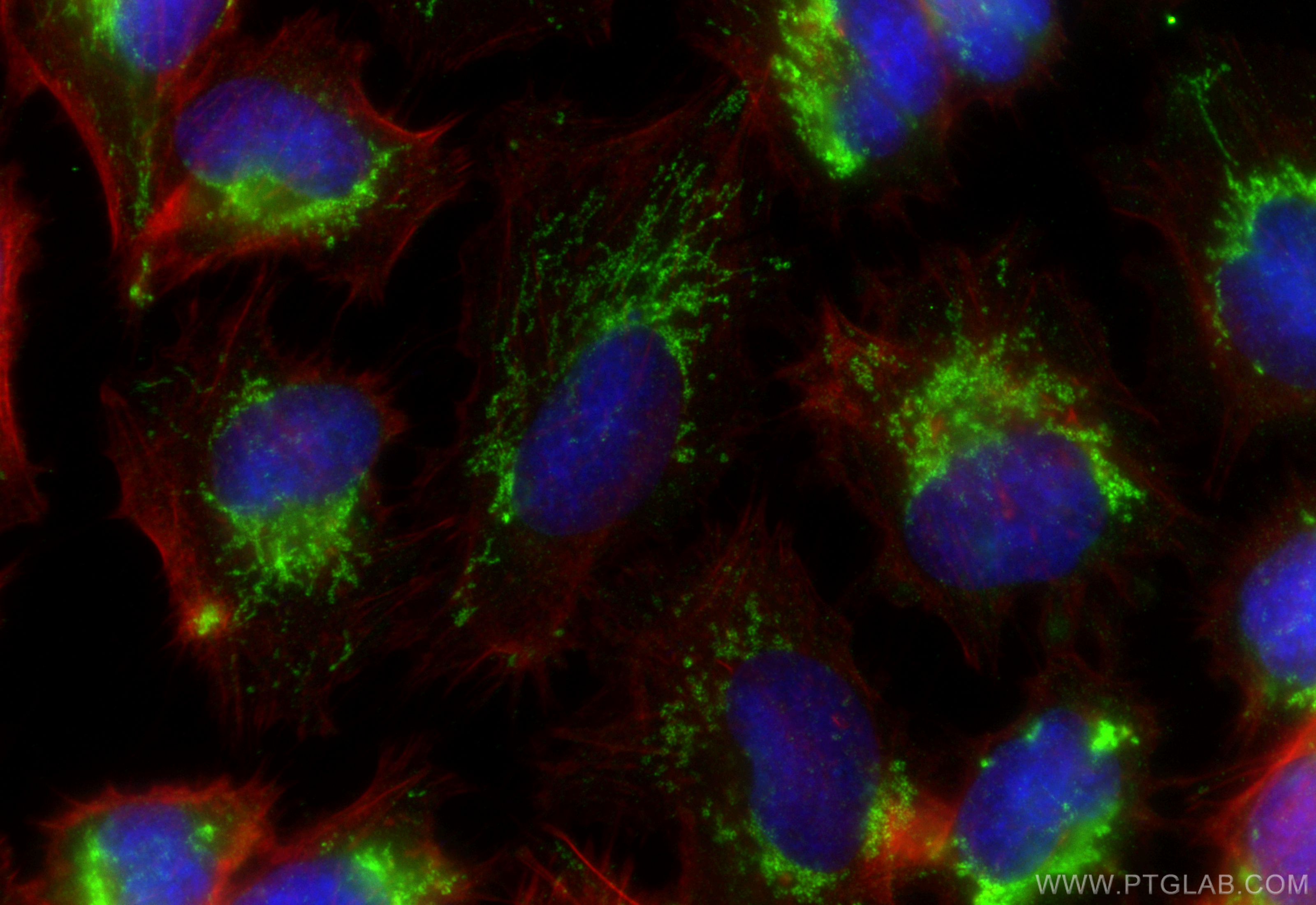 IF Staining of U-251 using 10997-2-AP