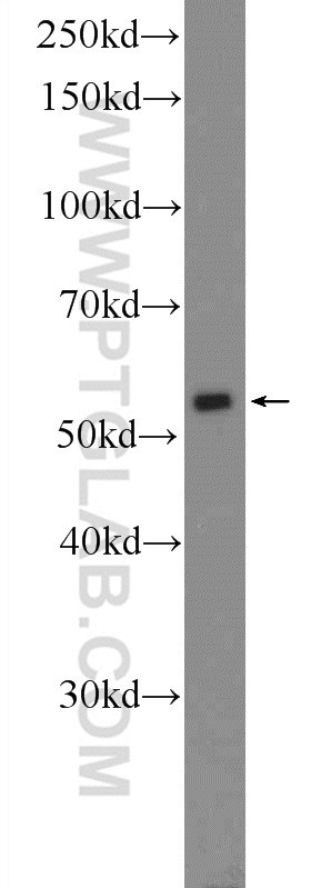 WB analysis of COLO 320 using 10997-2-AP