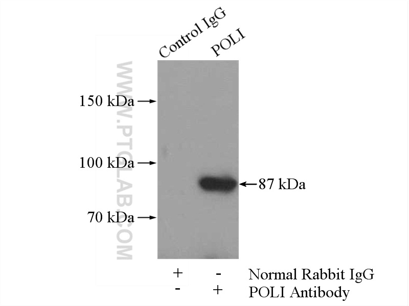 IP experiment of mouse testis using 13635-1-AP