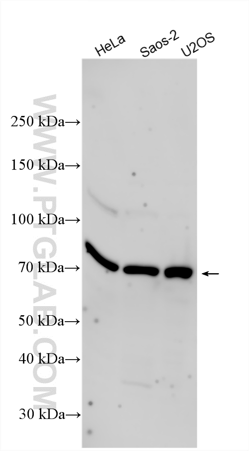 Various lysates were subjected to SDS PAGE followed by western blot with 14671-1-AP (POLL antibody) at dilution of 1:2000 incubated at room temperature for 1.5 hours. WB analysis using 14671-1-AP