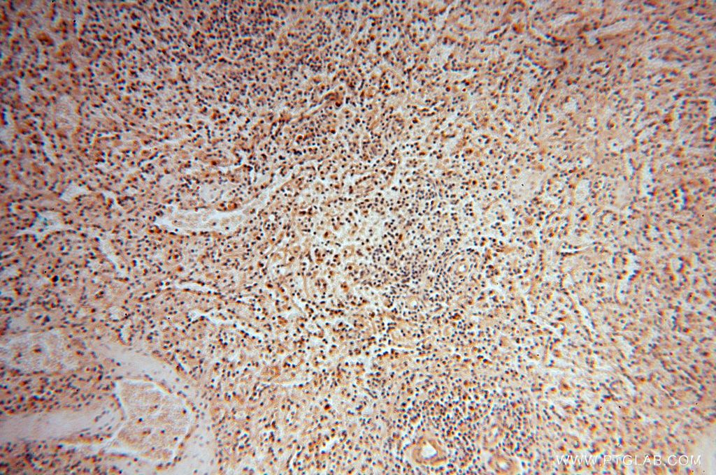 IHC staining of human spleen using 14873-1-AP