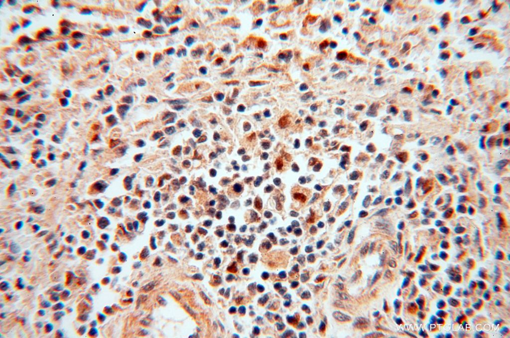 IHC staining of human spleen using 14873-1-AP