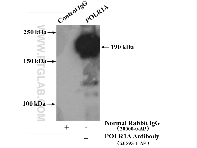 IP experiment of HeLa using 20595-1-AP