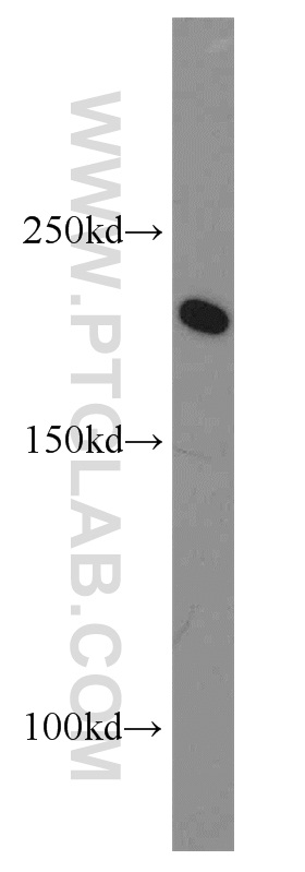 WB analysis of HeLa using 20595-1-AP