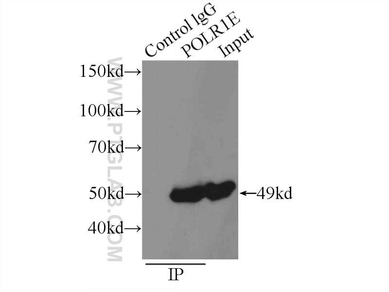 IP experiment of Jurkat using 16145-1-AP