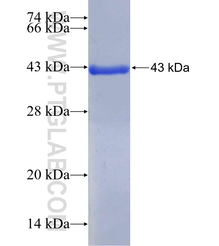 POLR2A fusion protein Ag29422 SDS-PAGE POLR2A fusion protein Ag29422 SDS-PAGE