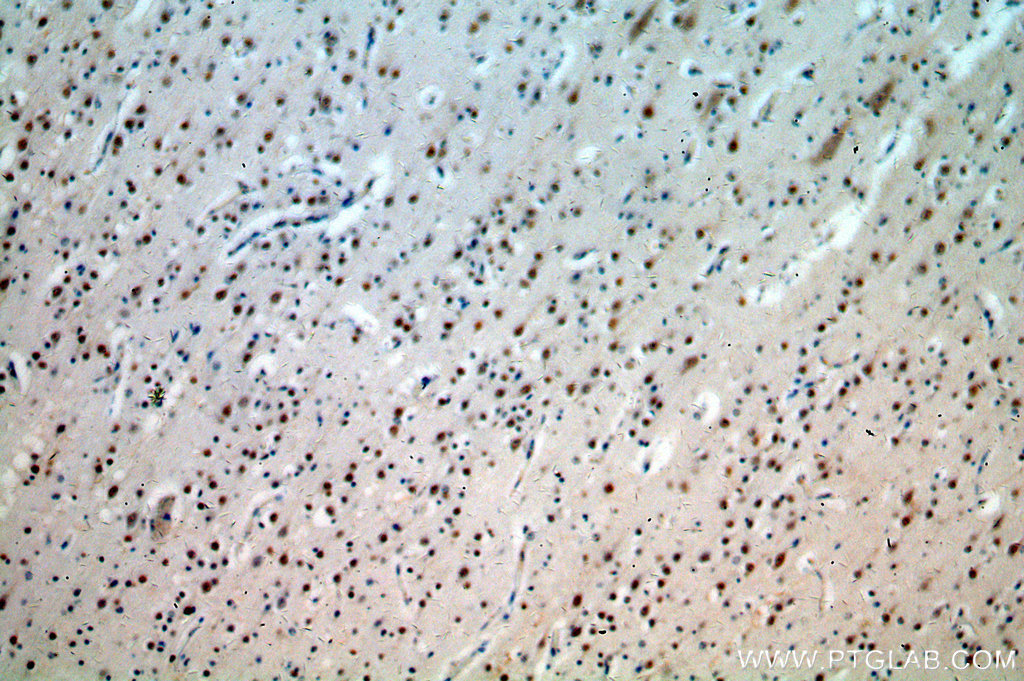 IHC staining of human brain using 20370-1-AP