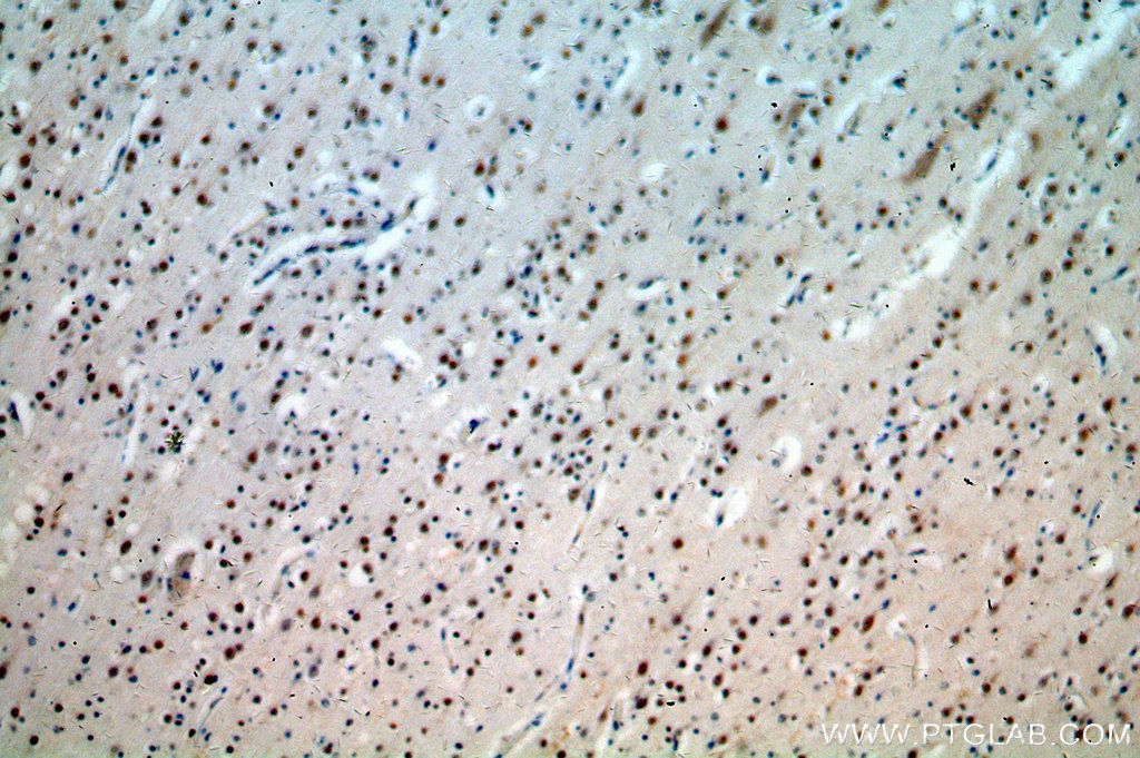 IHC staining of human brain using 20370-1-AP