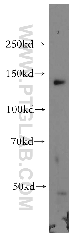 WB analysis of A431 using 20370-1-AP