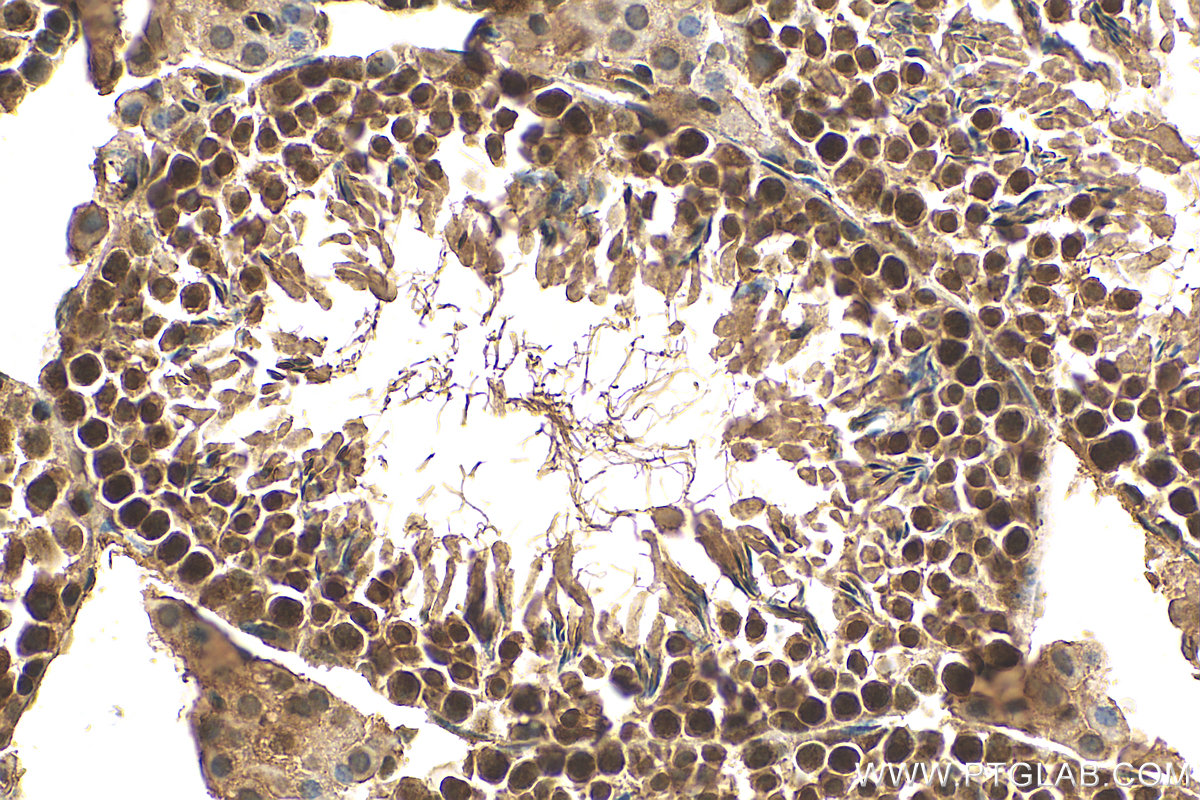 IHC staining of mouse testis using 16093-1-AP