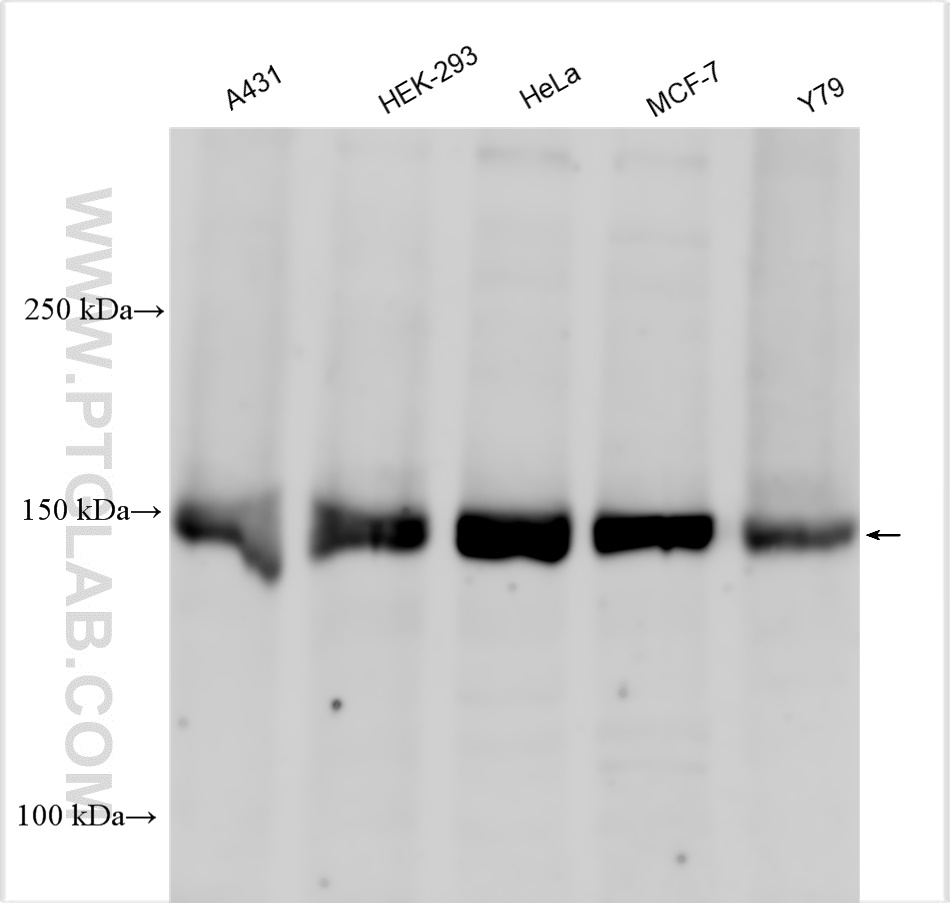WB analysis using 28842-1-AP
