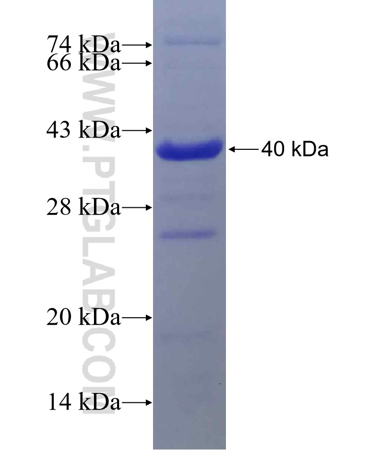 POLR3B fusion protein Ag10076 SDS-PAGE