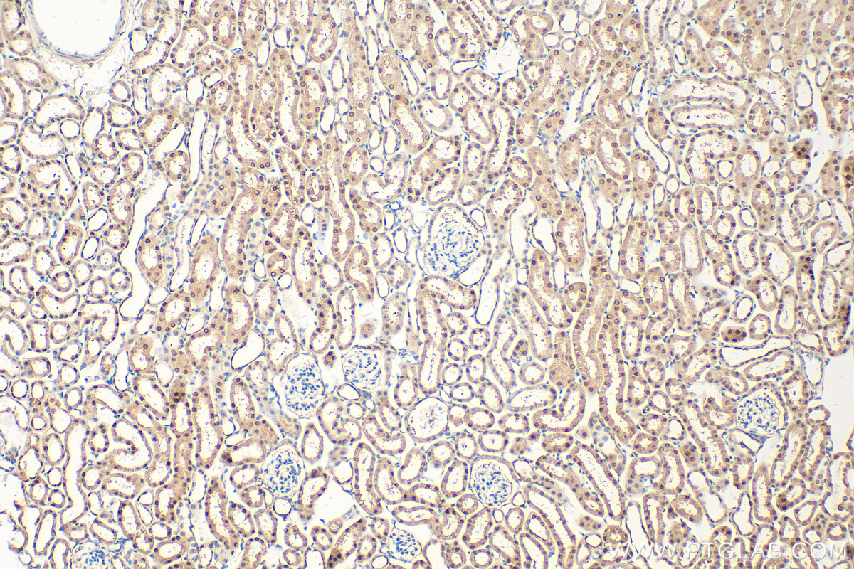 Immunohistochemical analysis of paraffin-embedded mouse kidney tissue slide using 27864-1-AP (POLR3C antibody) at dilution of 1:200 (under 10x lens). Heat mediated antigen retrieval with Tris-EDTA buffer (pH 9.0). IHC staining of mouse kidney using 27864-1-AP