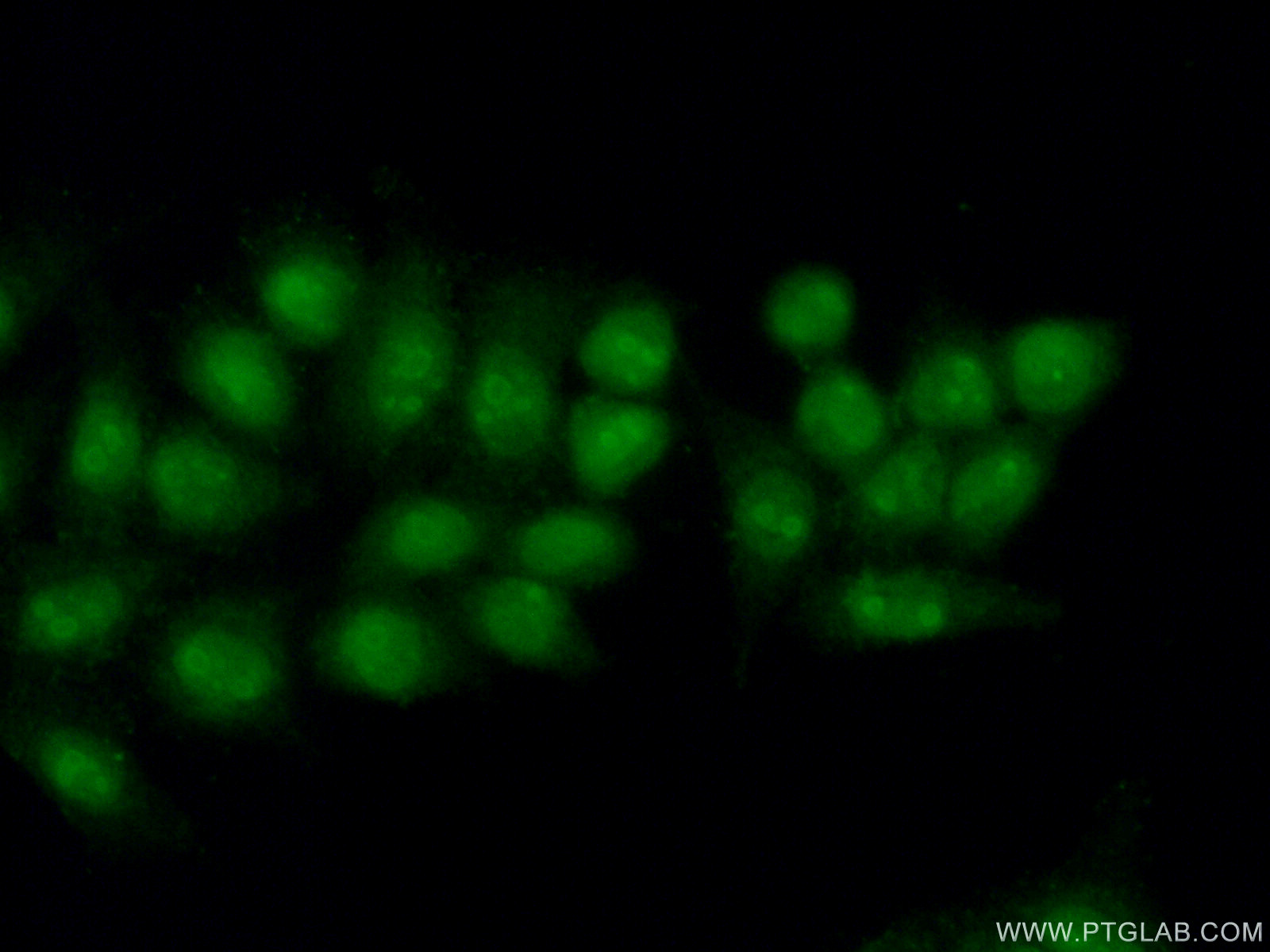 IF Staining of HeLa using 15339-1-AP