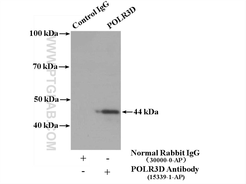 IP experiment of HeLa using 15339-1-AP