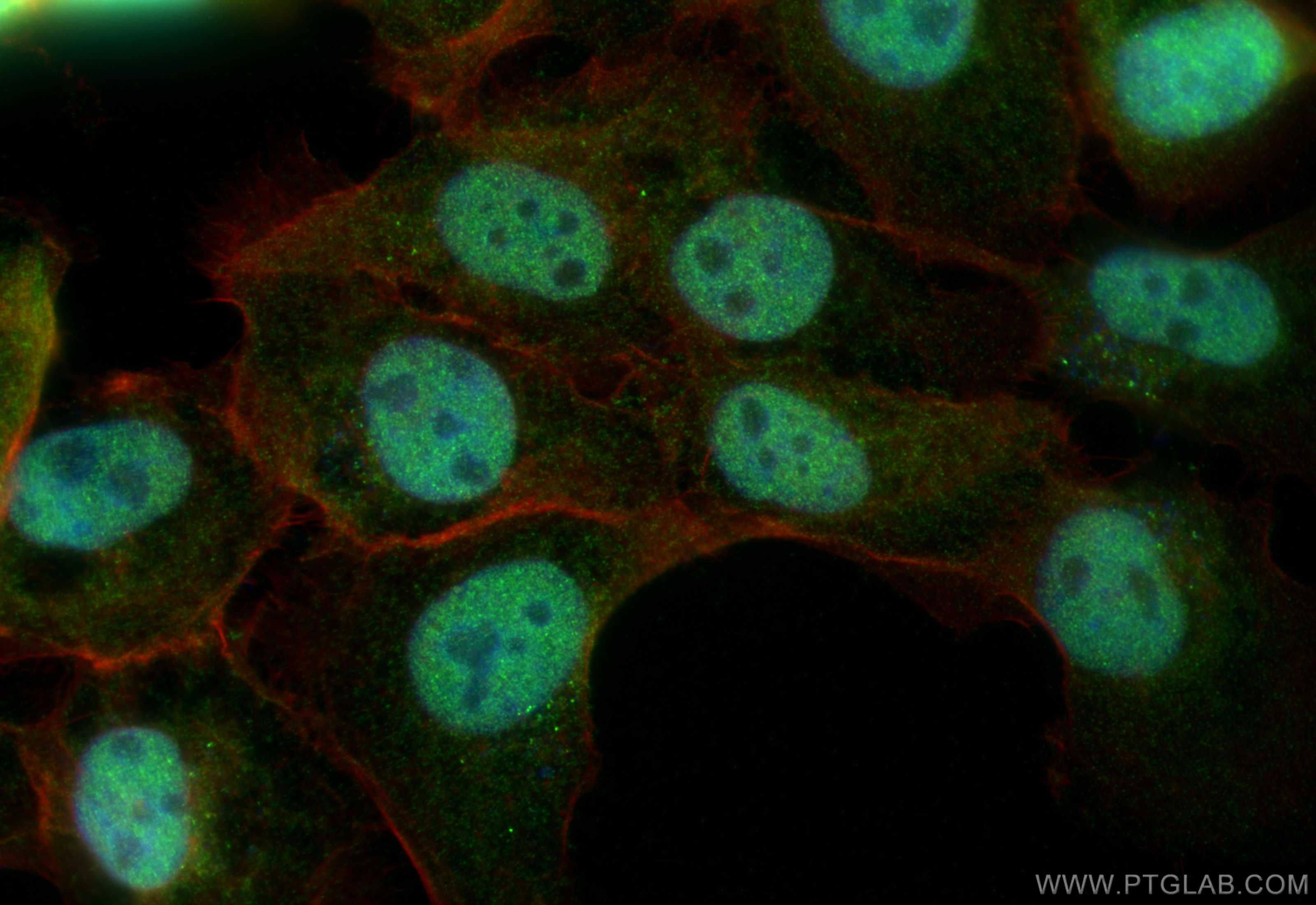 IF Staining of A431 using 16423-1-AP