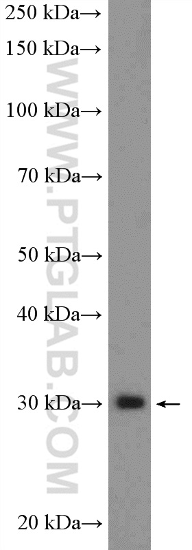 WB analysis of HeLa using 16423-1-AP