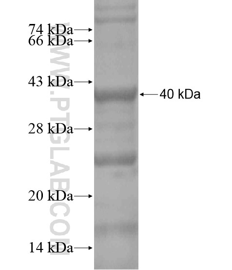 POLS fusion protein Ag18594 SDS-PAGE POLS fusion protein Ag18594 SDS-PAGE
