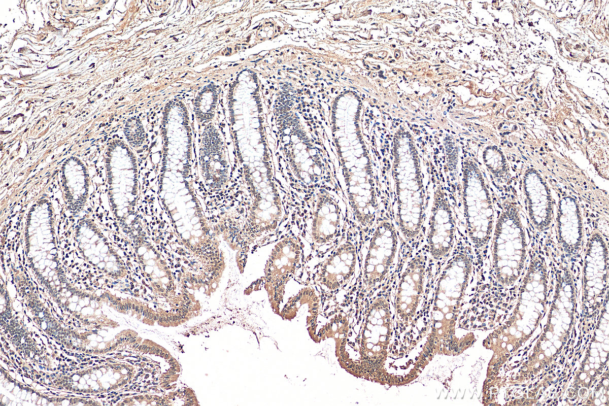 IHC staining of human colon using 15645-1-AP