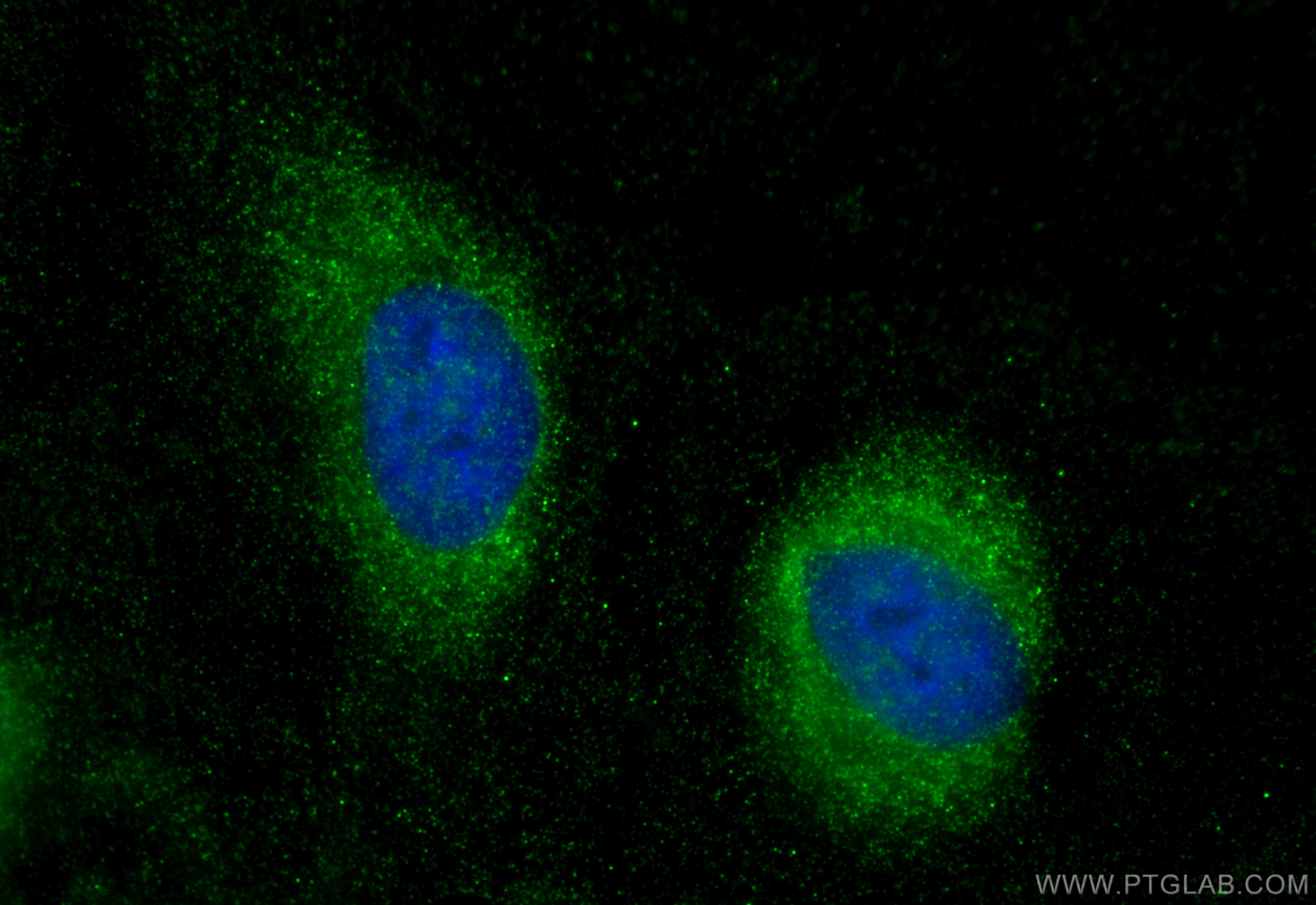 IF Staining of HeLa using 22102-1-AP
