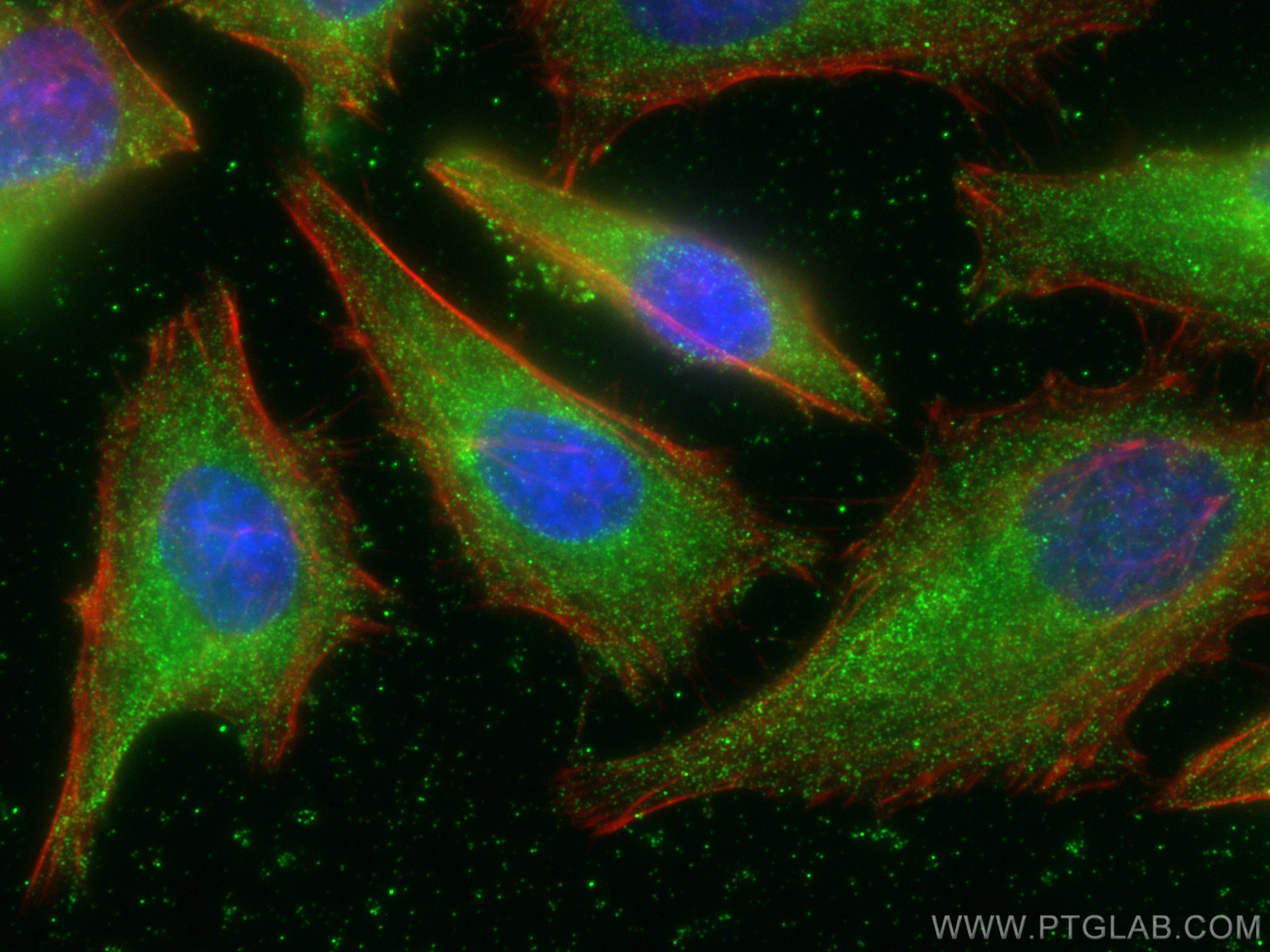 IF Staining of HeLa using 66358-1-Ig