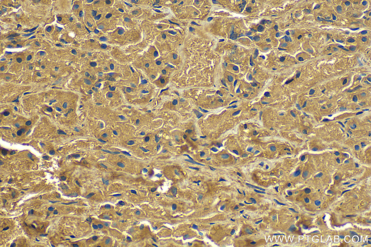 IHC staining of human pituitary using 66358-1-Ig