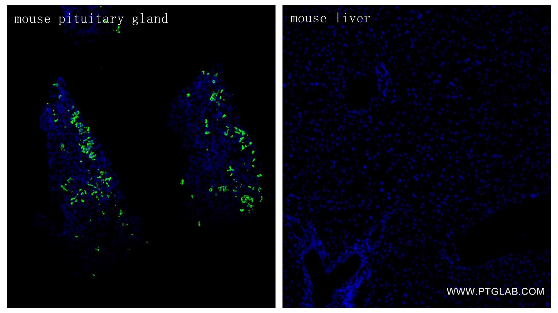 IF Staining of mouse pituitary gland using 82498-2-RR