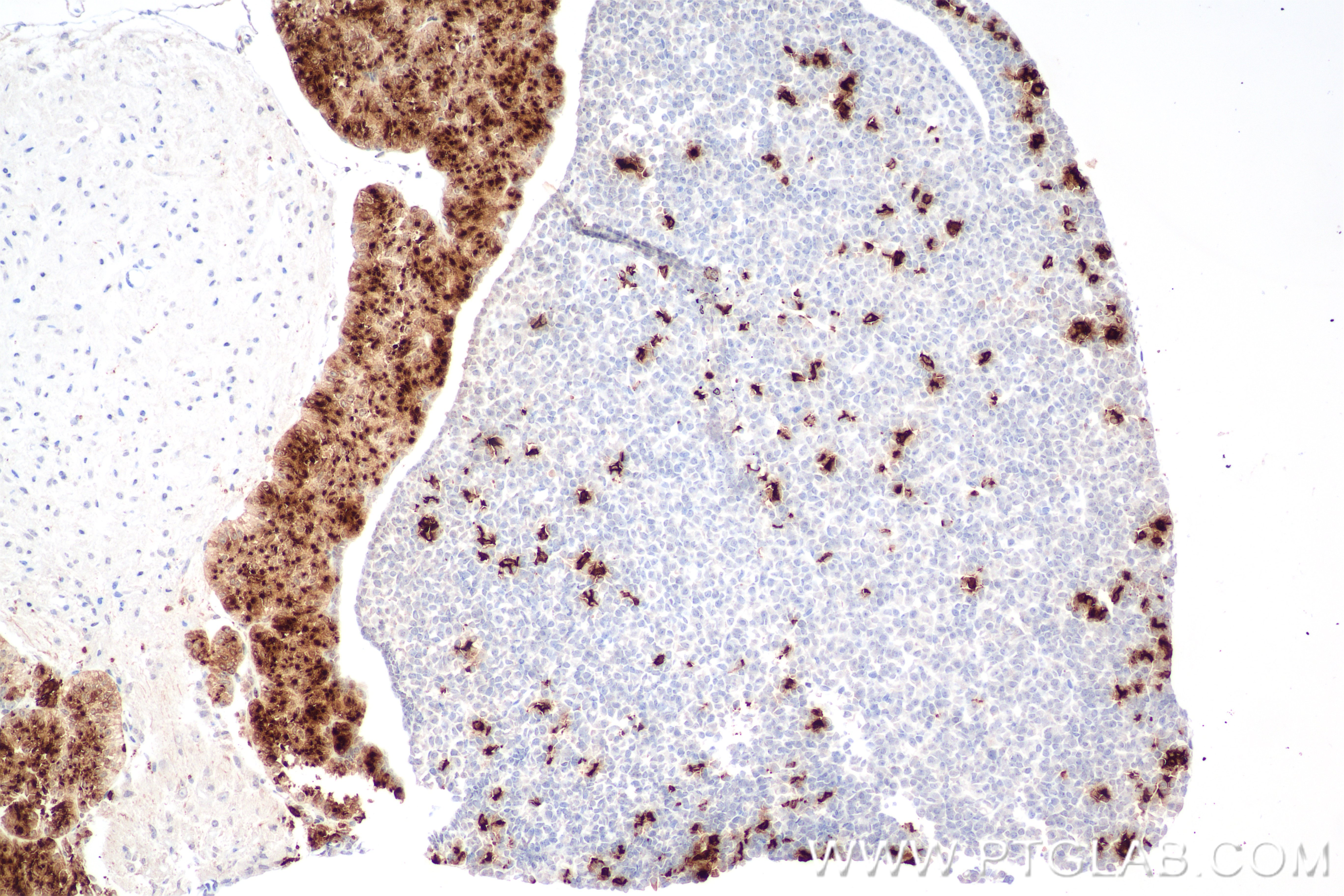 IHC staining of mouse pituitary gland using 82498-2-RR