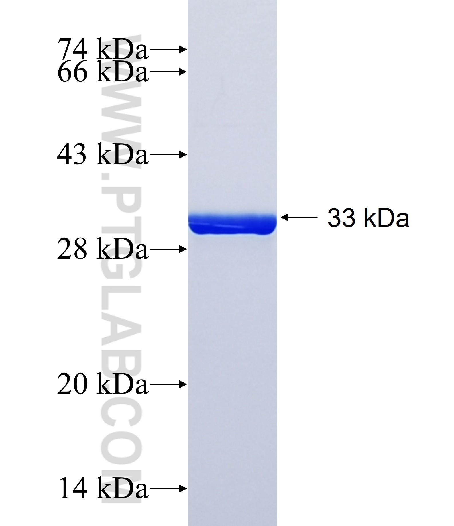 POMC fusion protein Ag40322 SDS-PAGE POMC fusion protein Ag40322 SDS-PAGE