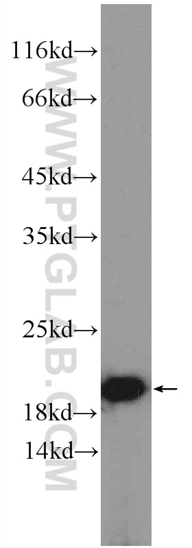 WB analysis of HeLa using 15046-1-AP