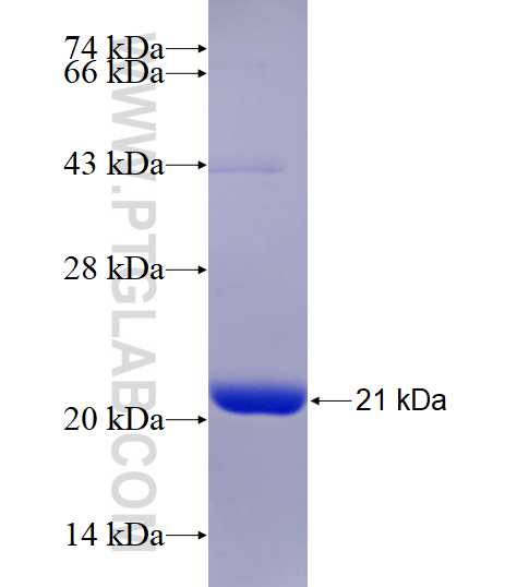 POMP fusion protein Ag6992 SDS-PAGE POMP fusion protein Ag6992 SDS-PAGE