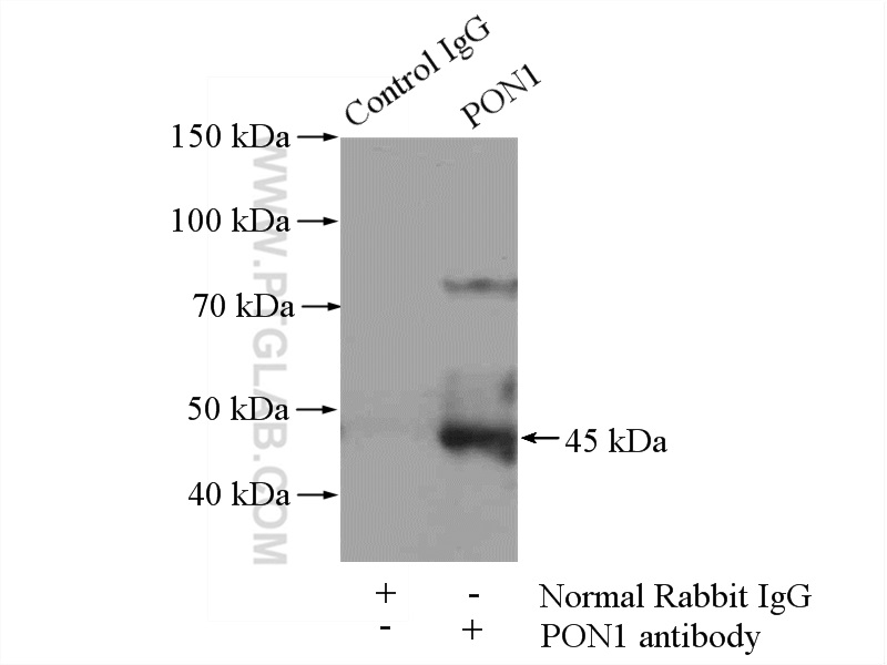 IP experiment of mouse liver using 18155-1-AP