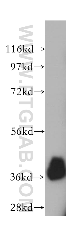 WB analysis of human liver using 14379-1-AP