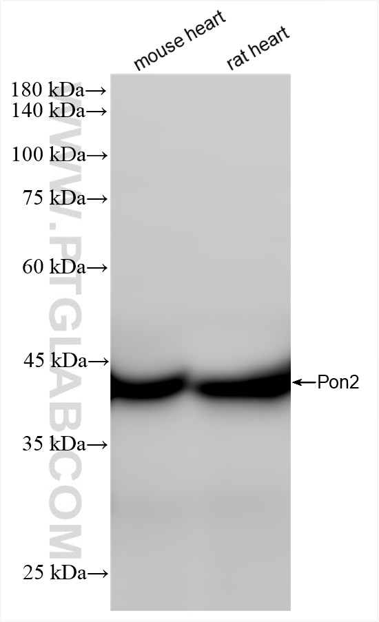 WB analysis using 85126-4-RR (same clone as 85126-4-PBS)