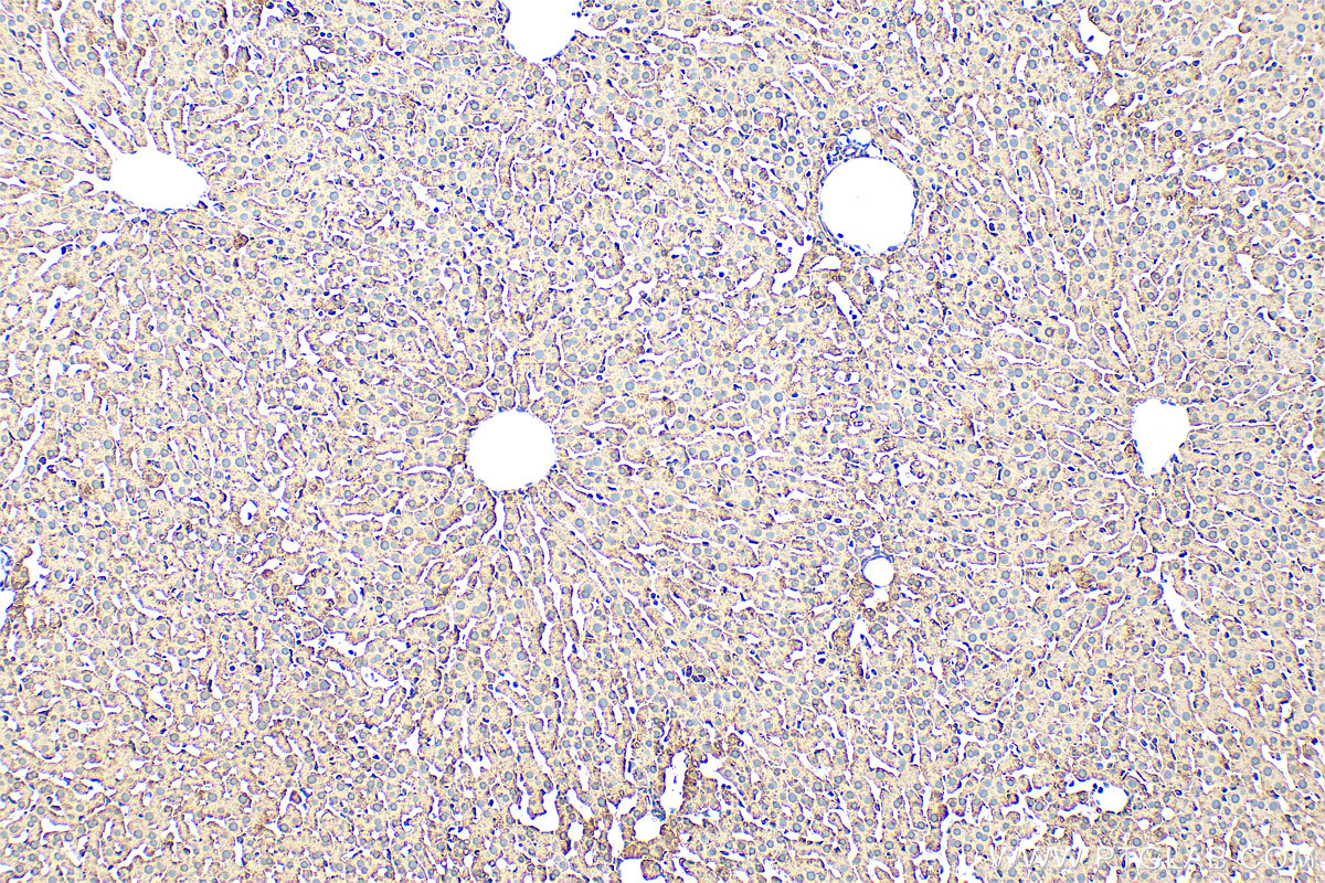 IHC staining of rat liver using 31793-1-AP