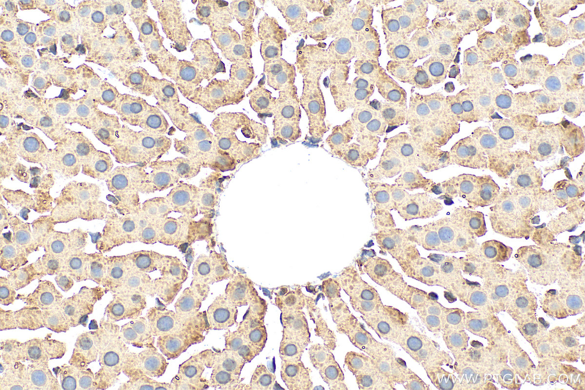 IHC staining of rat liver using 31793-1-AP